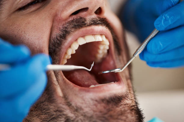 Best Same-Day Emergency Dental Services in Shamrock, TX