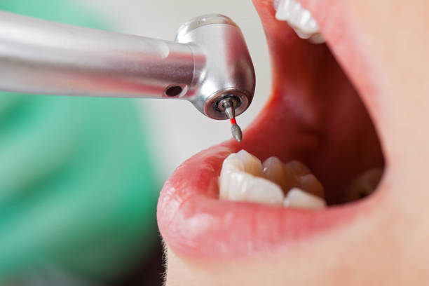 Best Emergency Dental Care for Broken or Chipped Teeth in Shamrock, TX